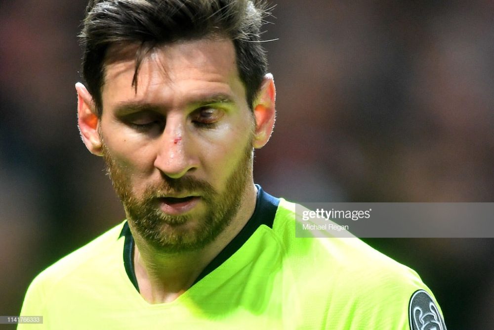An injured Lionel Messi